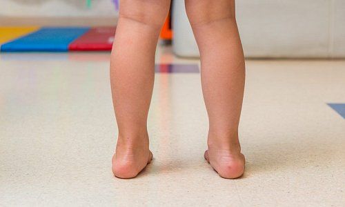 Нужно ли ребенку носить ортопедическую обувь? 