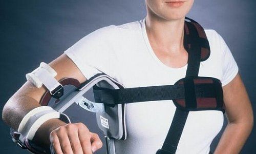 Лечим травмы плечевого сустава, используя отводящие шины